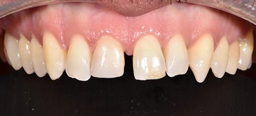 Smile Gallery - Before